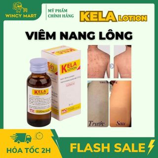   HÀNG CHUẨN  Dung Dịch Kela Lotion Chăm Sóc Da Viêm Lỗ Chân Lông Dày Sừng Nang Lông Và Giúp Da Mịn Màng 30ml 60ml 