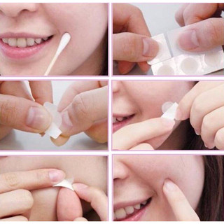 Miếng dán mụn Mayancare làm khô nhân mụn cấp tốc