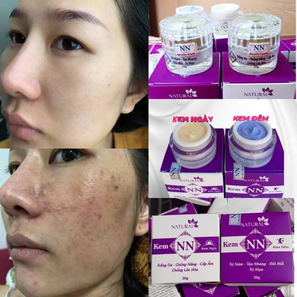 Kem NN mẫu mới chính hãng