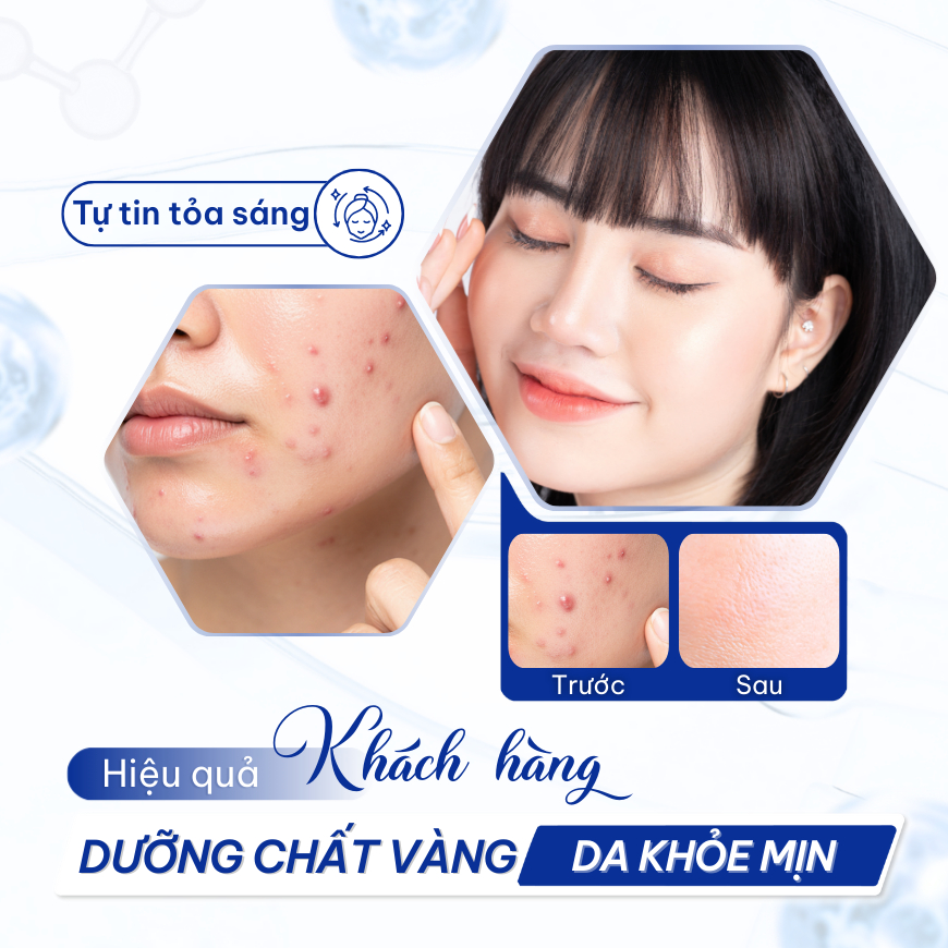 Serum Kiềm Dầu Giảm Mụn Compliment Niacinamide & Zinc - Sáng Da Mờ Thâm, Se Khít Lỗ Chân Lông 27ml | BigBuy360 - bigbuy360.vn