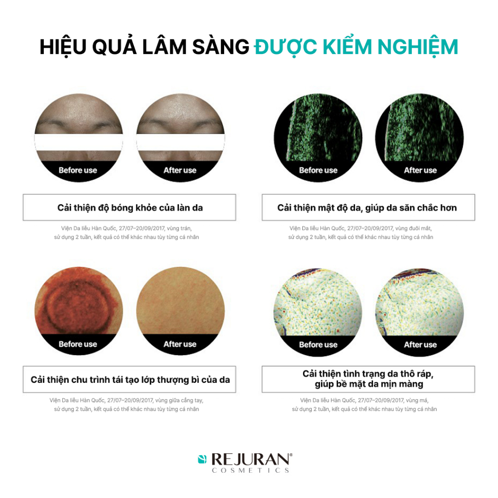 [CHỐNG LÃO HÓA] Tinh Chất DOT c-PDRN Hỗ Trợ Phục Hồi, Giúp Căng Bóng Cải Thiện Lão Hóa Sớm Rejuran Turnover Ampoule 30ml | BigBuy360 - bigbuy360.vn