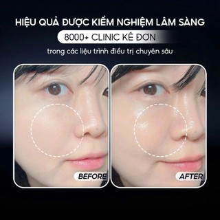 Combo Căng Bóng Chuẩn Hàn Phấn Nước Troiareuke Seoul Cushion & Xịt Dưỡng Khóa Nền Mahorosa Cream Mist 100ml Lenginstory