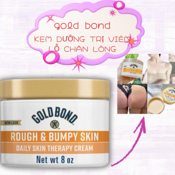 Kem dưỡng ẩm và dưỡng trắng da Gold Bond Rough & Bumpy Skin của Mỹ - Hàng Chính Hãng