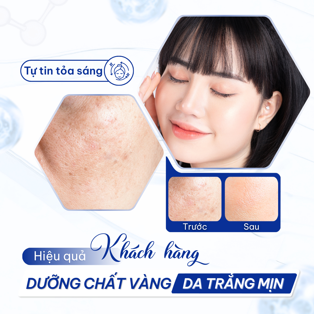 Serum Vitamin C 20% Compliment Dưỡng Trắng, Mờ Thâm Sạm, Cấp Ẩm Tăng Đàn Hồi 27ml | BigBuy360 - bigbuy360.vn