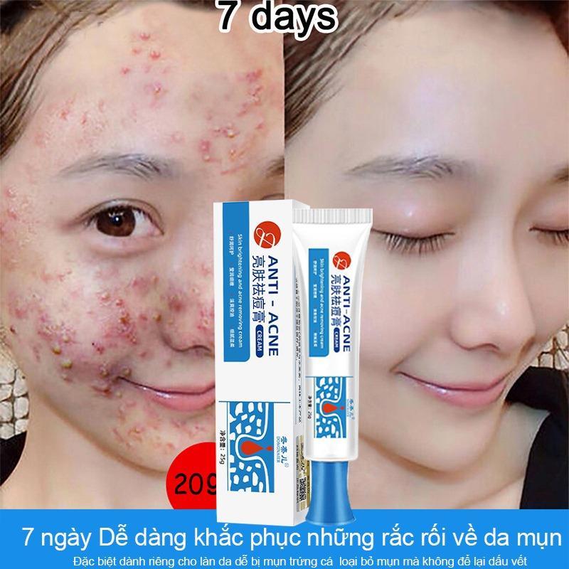 Loại bỏ mụn hiệu quả 100% nhanh chóng Giảm vết thâm,phục hồi sẹo,thu nhỏ lỗ chân lông Gel nha đam Ge