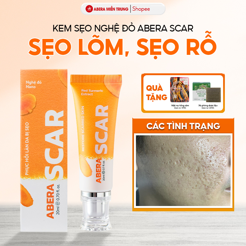 Kem Sẹo Nghệ Đỏ Abera Scar 20g - Hỗ Trợ Cải Thiện Sẹo Rỗ, Sẹo Lõm, Làm Mờ Vết Sẹo Thâm, Sẹo Tai Nạn,