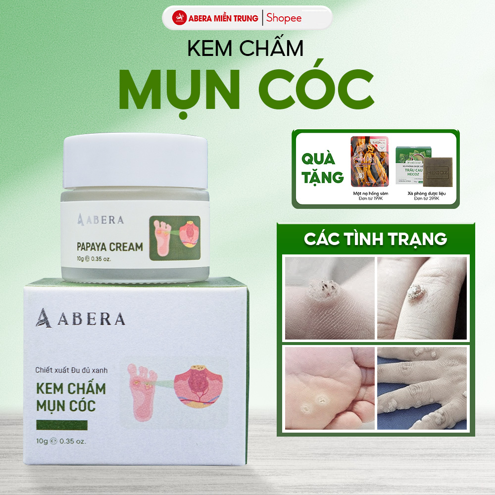 Kem Hỗ Trợ Giảm Mụn Cóc Abera Papaya – Góp Phần Loại Bỏ Tế Bào Chết, Làm Mềm Da Chai Sần & Vết Dày N