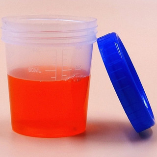Bộ 20 Cốc đựng mẫu 120ml có nắp