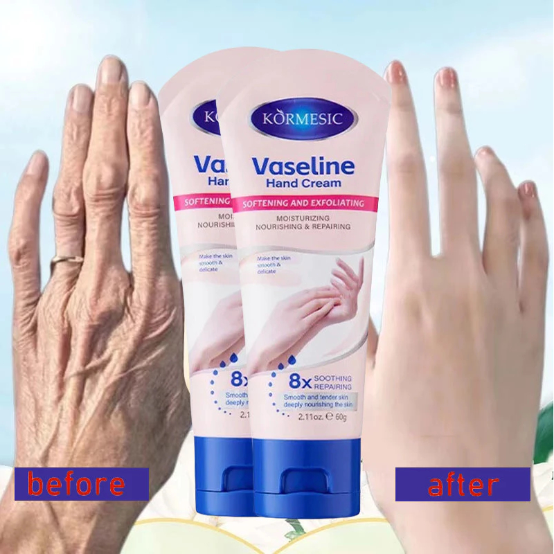 Vaseline Kem dưỡng da tay dưỡng ẩm dưỡng trắng da chống Lão Hóa 60g nuôi dưỡng khắc phục làn da khô thô ráp | BigBuy360 - bigbuy360.vn