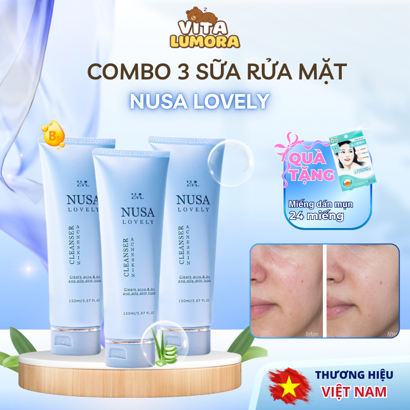 Combo 3 Sữa rửa mặt Nusa Lovely cho da dầu mụn – Làm sạch sâu, tặng 24 miếng dán mụn