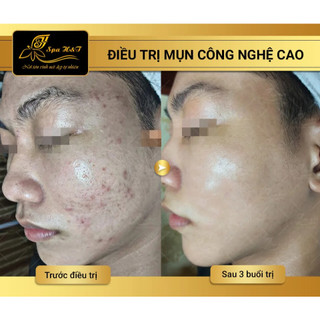 Tắm trắng linh chi vàng đủ giấy