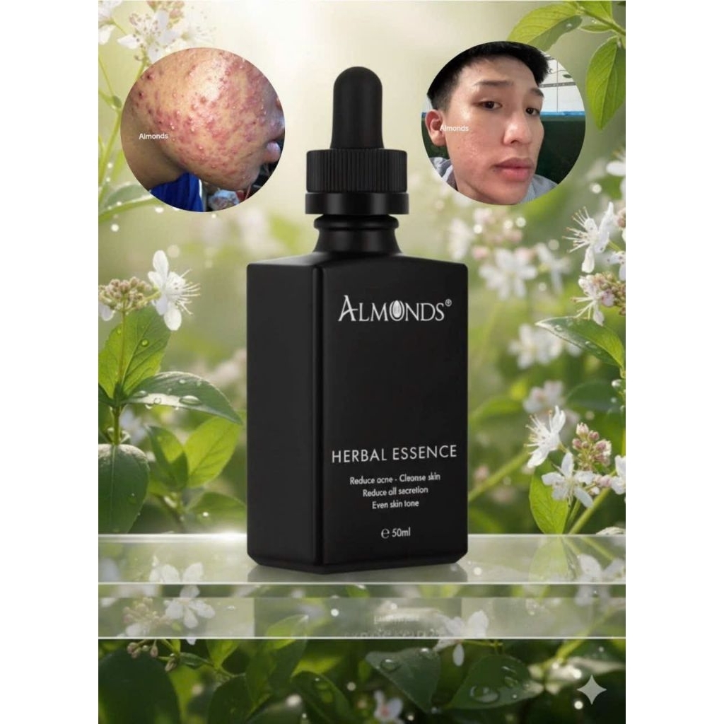 dịch chiết thảo mộc almonds (mẫu mới)