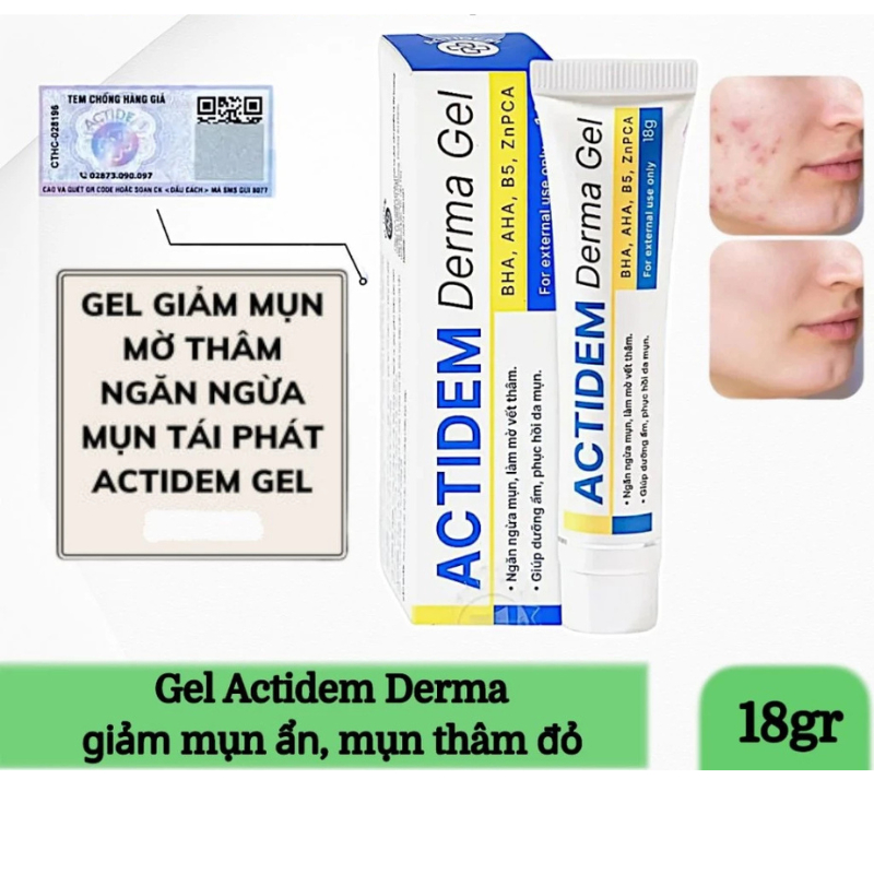(DATE MỚI) Actidem Extra Gel 18GRAM dưỡng Giảm Mụn Ẩn, Ngừa Thâm, Giảm Thâm Đỏ Sau Mụn chính hãng
