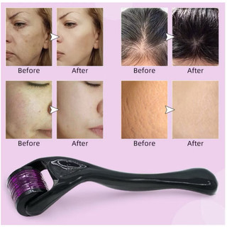 Kim Lăn Tay Tím Derma Roller 540 Đầu Kim Chuyên Dụng Đủ Size Cho Spa (Hàng Loại 1 Có Hộp Vô Khuẩn)