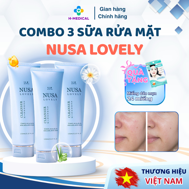 Combo 3 Sữa rửa mặt Nusa Lovely cho da dầu mụn, sạch sâu giảm nhờn – Tặng miếng dán mụn hộp 24 miếng