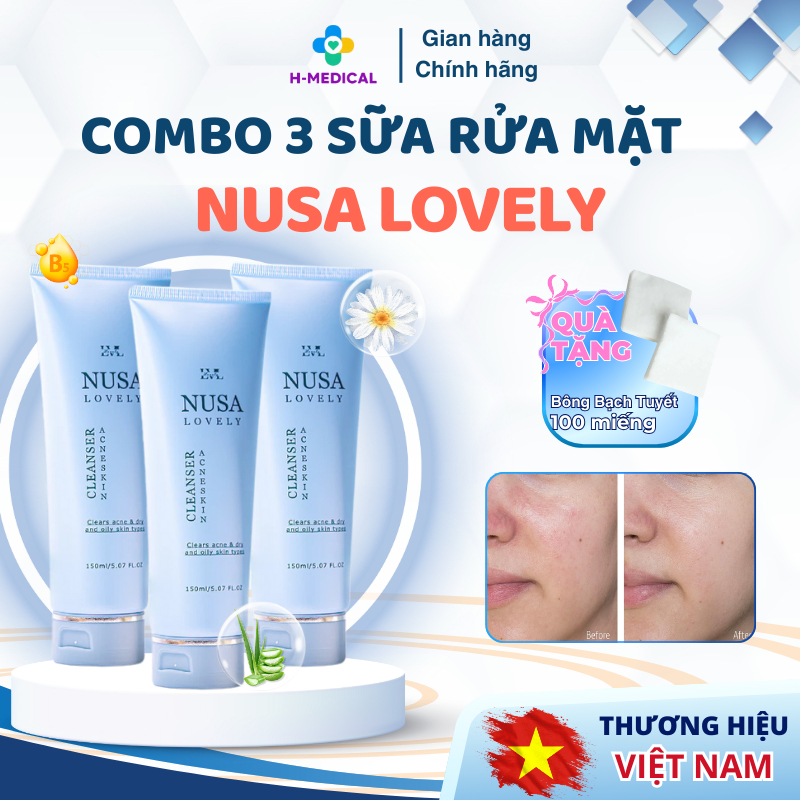 Combo 3 Sữa rửa mặt Nusa Lovely cho da dầu mụn, sạch sâu giảm nhờn – Tặng bông Bạch Tuyết 100 miếng