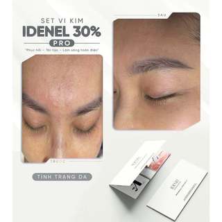 Vi kim sinh học gold & caviar – raphitox spot solution