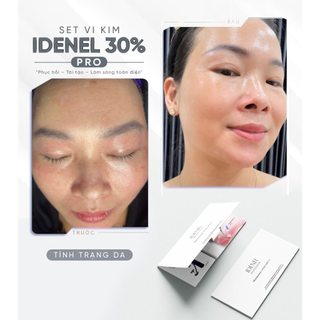Vi kim sinh học gold & caviar – raphitox spot solution