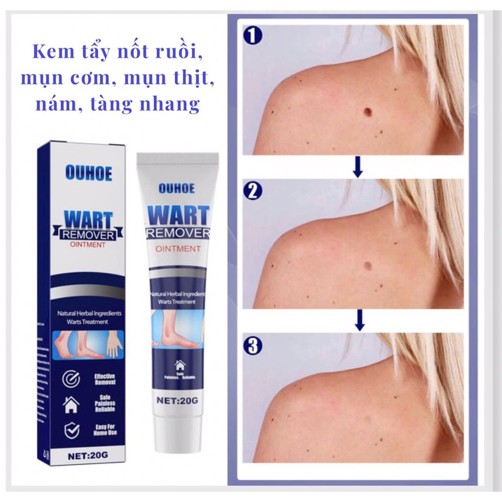 OUHOE WART REMOVER Kem Tẩy Mụn Thịt, Mụn Ruồi Chính Hãng Nhập Khẩu USA hàng chính hãng ghch33