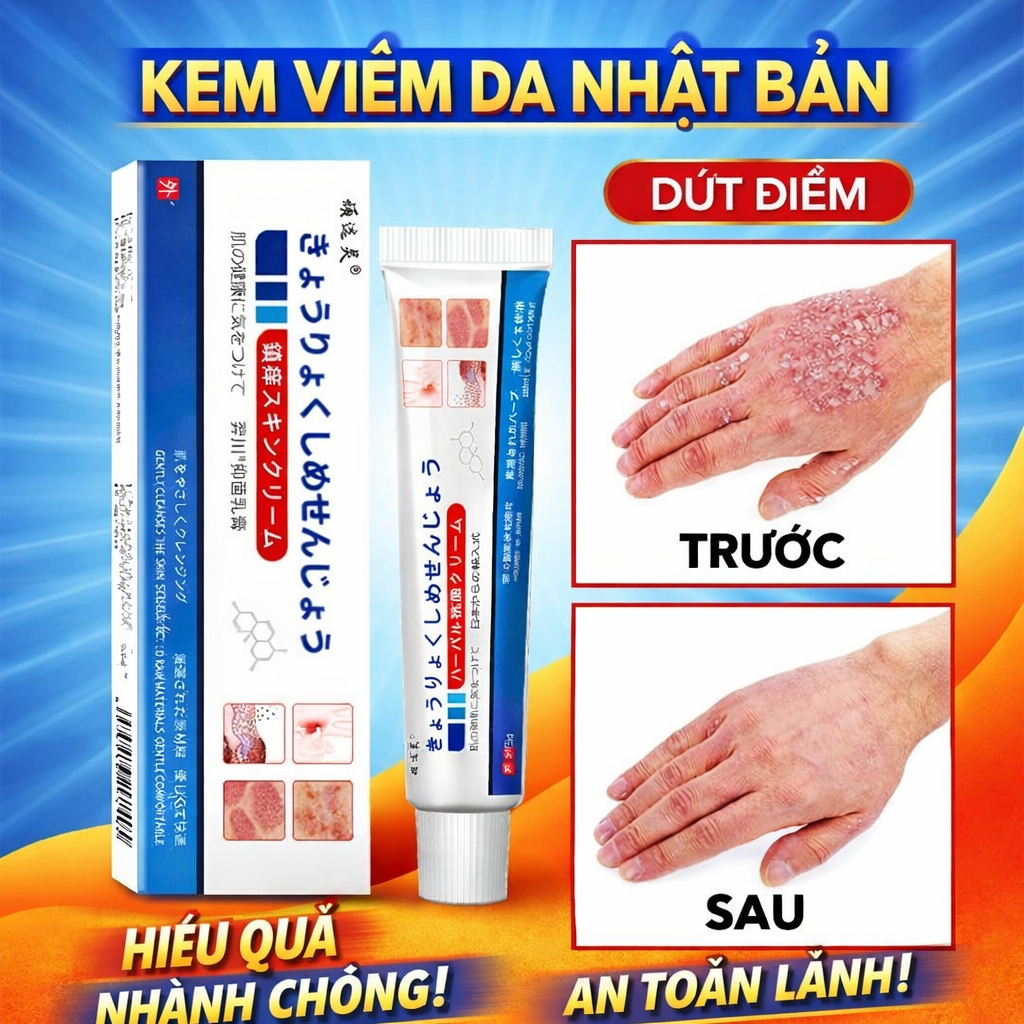 Kem Bôi Da NHẬT BẢN Dứt Điểm Viêm Da Cơ Địa Nấm Ngứa, Hắc Lào, Tổ Đỉa, Ghẻ Nước Cực Kì Hiệu Quả