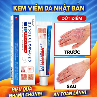Kem Bôi Da NHẬT BẢN Dứt Điểm Viêm Da Cơ Địa Nấm Ngứa, Hắc Lào, Tổ Đỉa, Ghẻ Nước Cực Kì Hiệu Quả