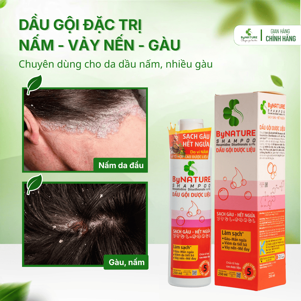 Dầu Gội Sạch Gàu, Nấm Ngứa Da Đầu ByNature Dược Liệu, Thương Hiệu ByNature