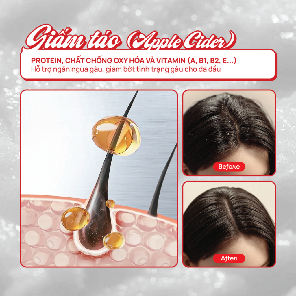 Ttbc da đầu giấm táo Scrubie 180m dành cho da đầu dầu nhanh bết; hỗ trợ sạch tóc, giảm ngứa gàu | BigBuy360 - bigbuy360.vn