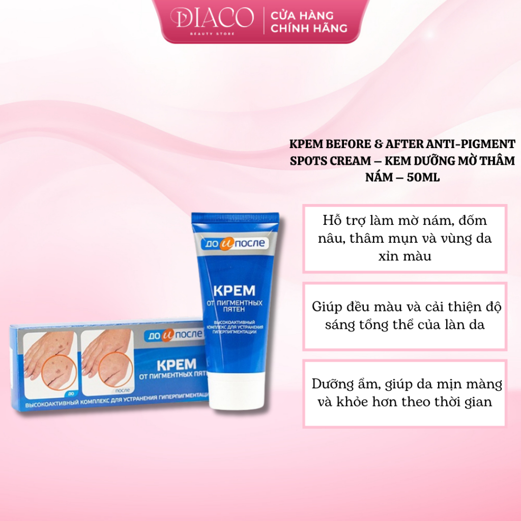 KPEM BEFORE & AFTER ANTI-PIGMENT SPOTS CREAM – KEM DƯỠNG MỜ THÂM NÁM – 50ML