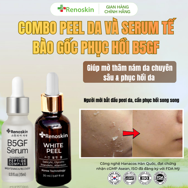 Combo Peel da Renoskin White Peel bóc tách nám tàn nhang, thâm, mụn, da sần sùi… Phục hồi da serum B