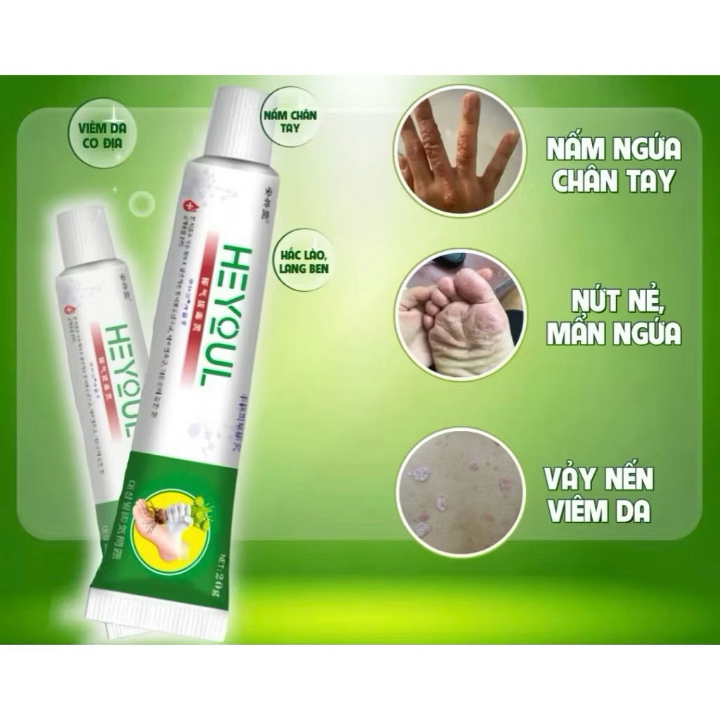 Kem Bôi Ngoài Da Heyoul Hàn Quốc 20g Hỗ Trợ Chăm Sóc Da Nhạy Cảm, Giảm Cảm Giác Ngứa Khó Chịu