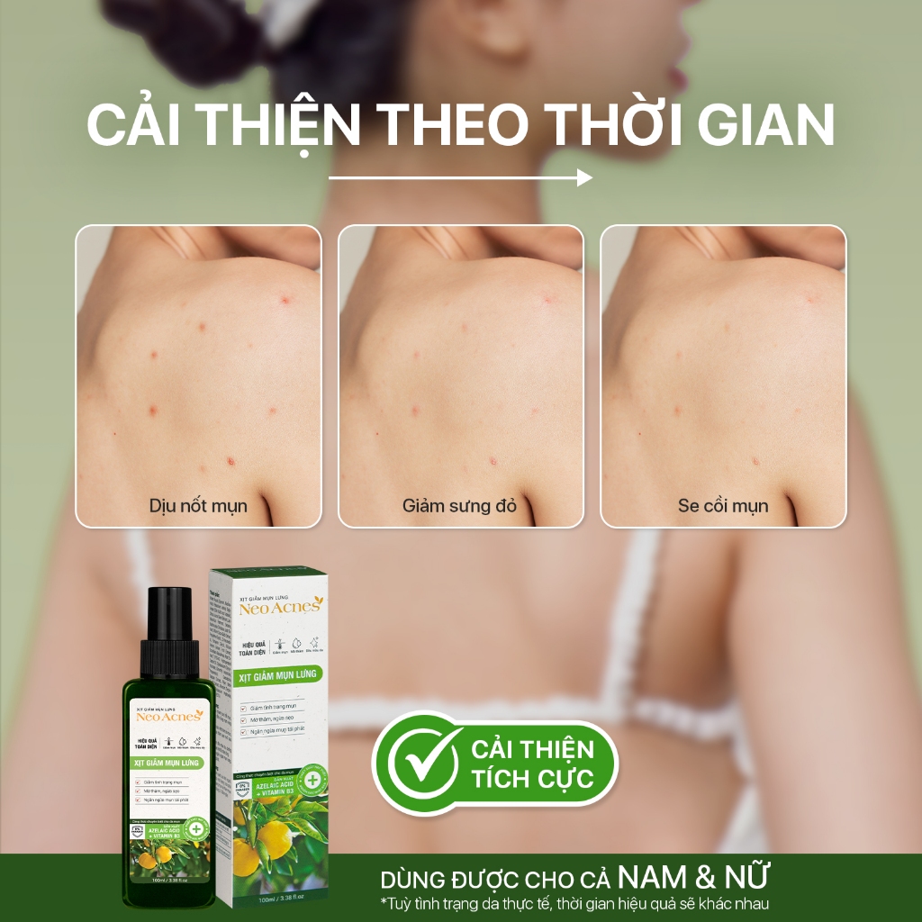 Xịt giảm mụn lưng, giảm viêm nang lông Neoacnes sạch mụn, mờ thâm giảm viêm 100ml | BigBuy360 - bigbuy360.vn