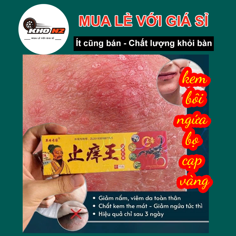 Kem bôi ngứa Bọ cạp Vàng chính hãng. bôi hắc lào, nấm ngứa, á sừng,vẩy nến, ngứa da đầu, ghẻ