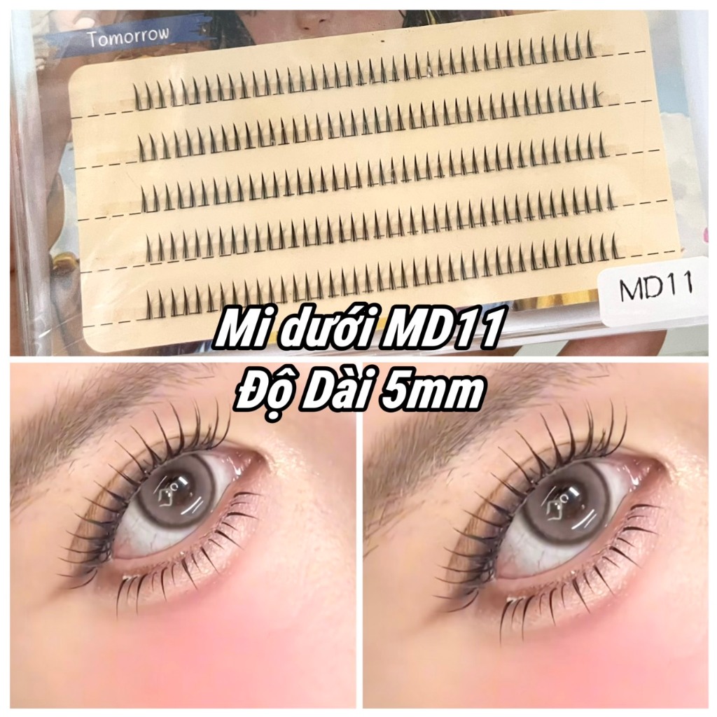 Mi Dưới MD11 Độ Dài 5mm