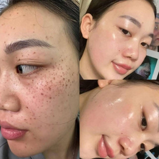 𝐂𝐨𝐦𝐛𝐨 𝐌𝐢𝐱 5 (𝐂𝐡𝐚̂́𝐦 𝐓𝐚̀𝐧 𝐍𝐡𝐚𝐧𝐠 𝐍𝐚́𝐦 𝐌𝐮̣𝐧 𝐑𝐨̂̃ -𝐁𝐚̣̂𝐭 𝐠𝐨̂́𝐜 𝐧𝐚́𝐦-𝐬𝐞𝐫𝐮𝐦-𝐜𝐚𝐨 𝐥𝐚̣𝐧𝐡-𝐓𝐚́𝐢 𝐓𝐚̣𝐨 𝐃𝐚 𝐂𝐚𝐨 𝐂𝐚̂́𝐩 𝐊𝐡𝐨̂𝐧𝐠 𝐒𝐮̛𝐧𝐠)