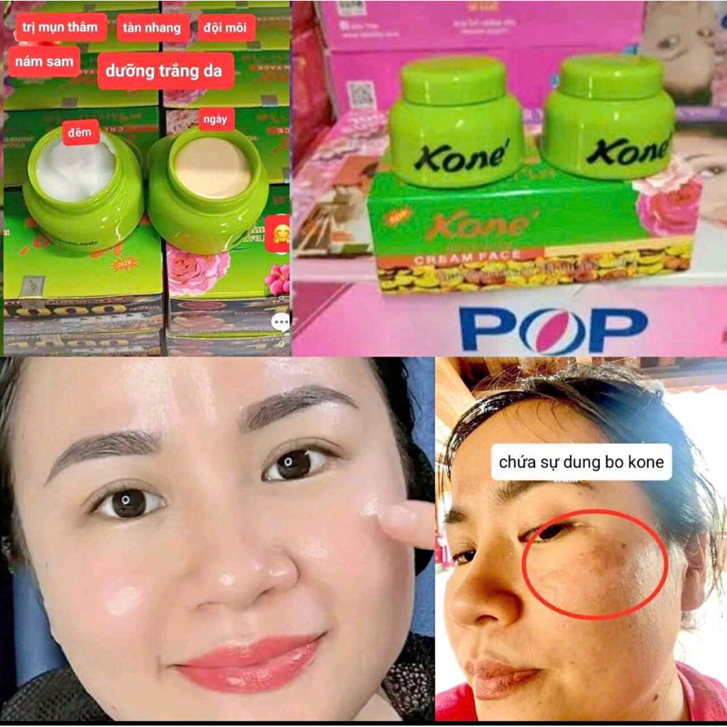 Kone cặp ngày đêm