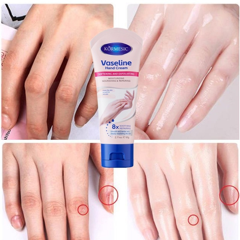 Kem Dưỡng Da Tay Vaseline KORMESIC Dưỡng Trắng Da Dưỡng Ẩm, Làm Dịu, Bổ Sung Độ Ẩm Cho Da, Chống Nhăn, Lão Hoá, Nứt Nẻ | BigBuy360 - bigbuy360.vn