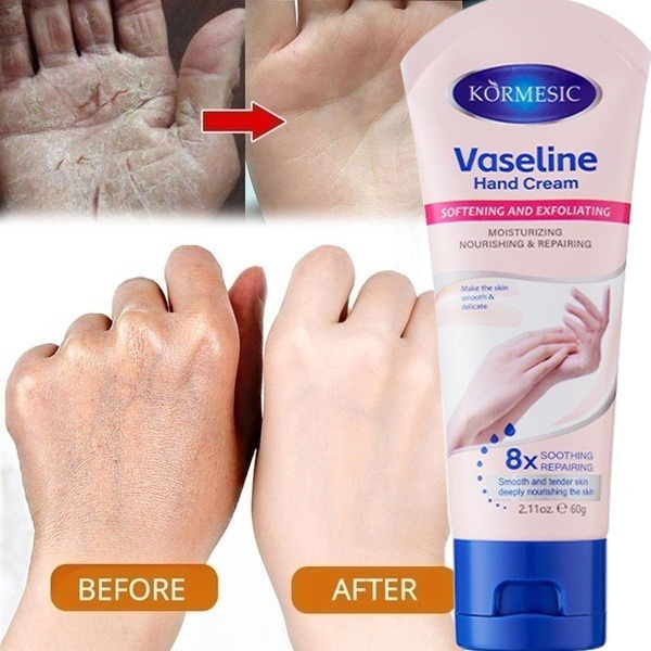 Kem Dưỡng Da Tay Vaseline KORMESIC Dưỡng Trắng Da Dưỡng Ẩm, Làm Dịu, Bổ Sung Độ Ẩm Cho Da, Chống Nhăn, Lão Hoá, Nứt Nẻ | BigBuy360 - bigbuy360.vn