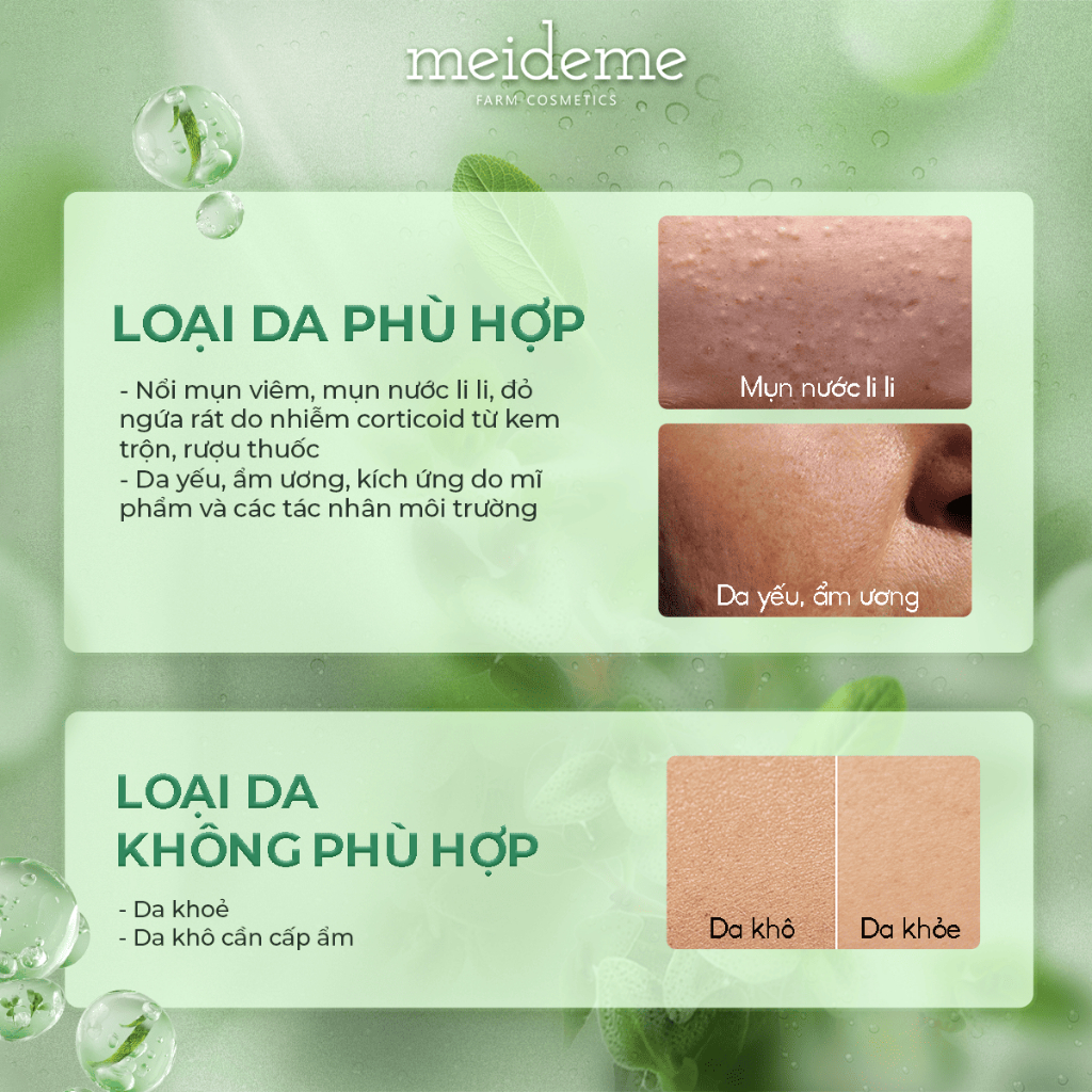 Toner dập viêm dịu da MEIDEME Green Salvia Treatment Toner 200ml | BigBuy360 - bigbuy360.vn