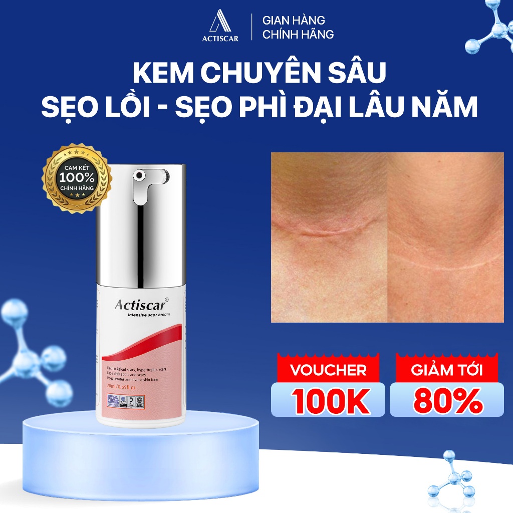 Kem Mờ Sẹo Lồi To, Sẹo Phì Đại Actiscar Hỗ Trợ Làm Mềm Sẹo, Phẳng Sẹo Và Giảm Thâm