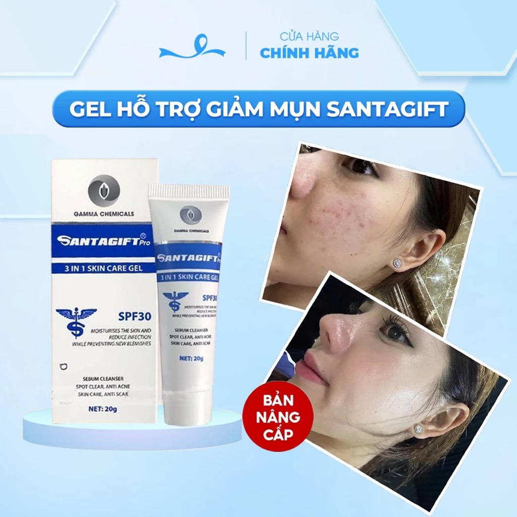 Gel hỗ trợ giảm mụn Gamma SANTAGIFT 20g Skincare Làm Đẹp Da - Mờ Thâm - Hiệu Quả