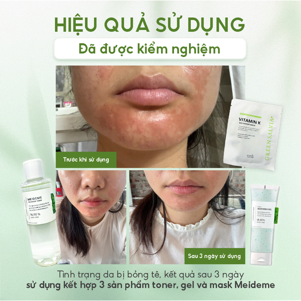 Gel làm dịu phục hồi cấp tốc cho da nhạy cảm - MEIDEME Green Salvia Multi Soothing Gel 70ml | BigBuy360 - bigbuy360.vn