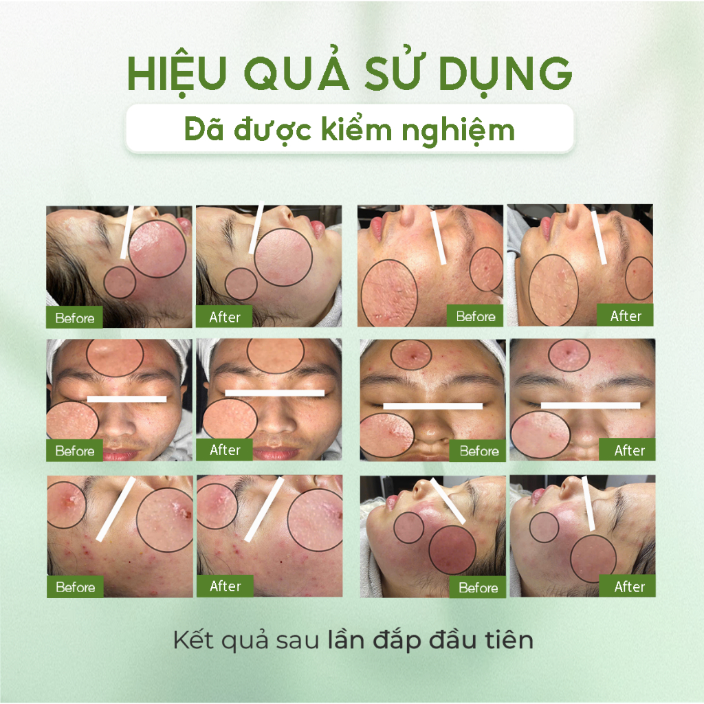 Gel làm dịu phục hồi cấp tốc cho da nhạy cảm - MEIDEME Green Salvia Multi Soothing Gel 70ml | BigBuy360 - bigbuy360.vn