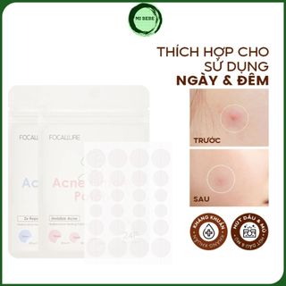 Miếng dán mụn FOCALLURE nhiều kích cỡ tiện lợi trong suốt siêu mỏng chính hãng 24 miếng - Mibebe