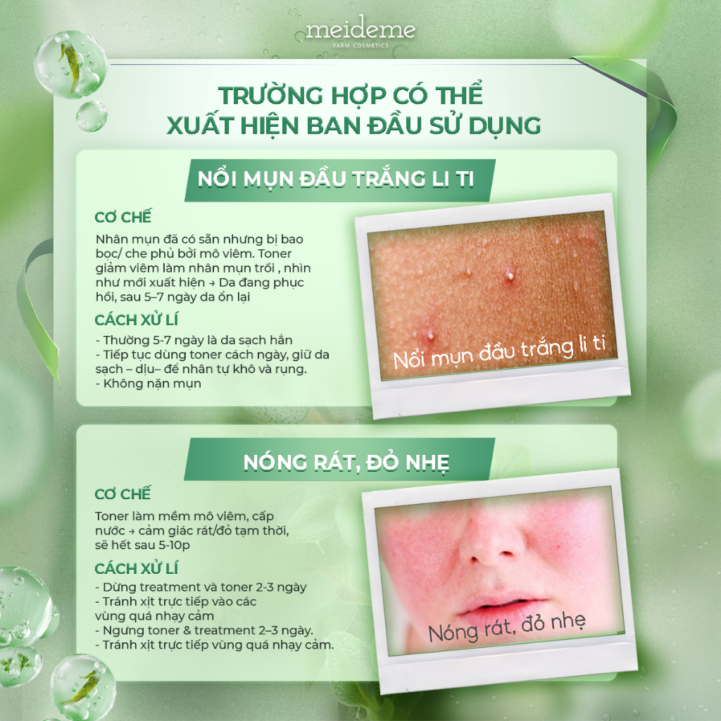 Toner dập viêm dịu da MEIDEME Green Salvia Treatment Toner 200ml | BigBuy360 - bigbuy360.vn