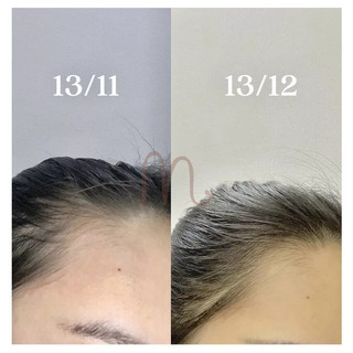 HERBAL OIL SERUM Dưỡng Tóc & Da ( kèm feedback )