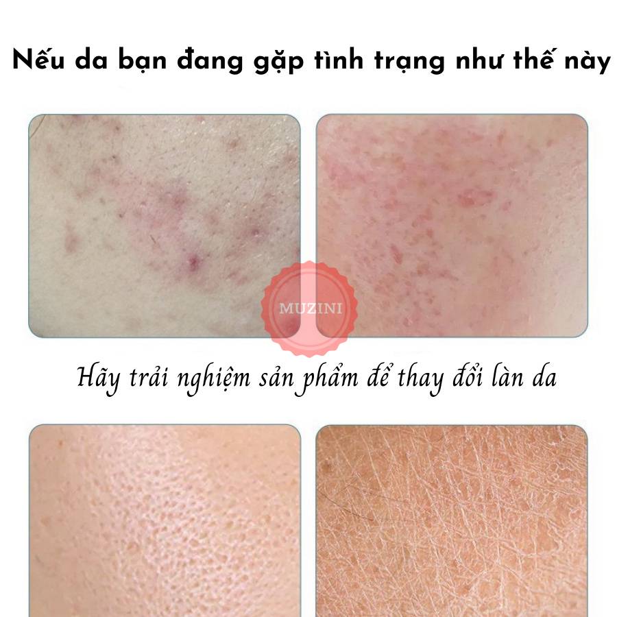 Mặt nạ trắng da chăm và sóc da mặt nạ giấy hương vị trái cây vitamin dưỡng trắng da kiểm soát dầu Muzini MN02 | BigBuy360 - bigbuy360.vn