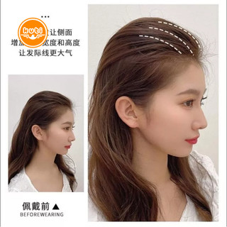 Set 3 kẹp phồng mái