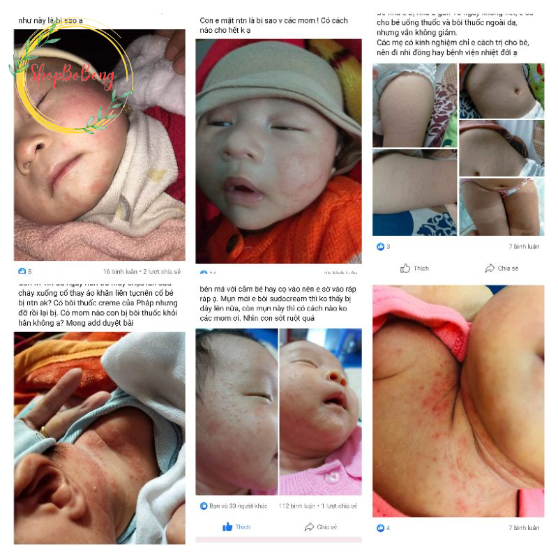 Kem Hăm Dr.baby - Baby Care Cream Giải Pháp Cho Hăm Tã Chàm Sữa Rôm Sảy Mẩn Ngứa Mụn Nhọt