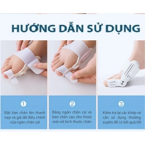 Nẹp chỉnh hình xương ngón chân cái