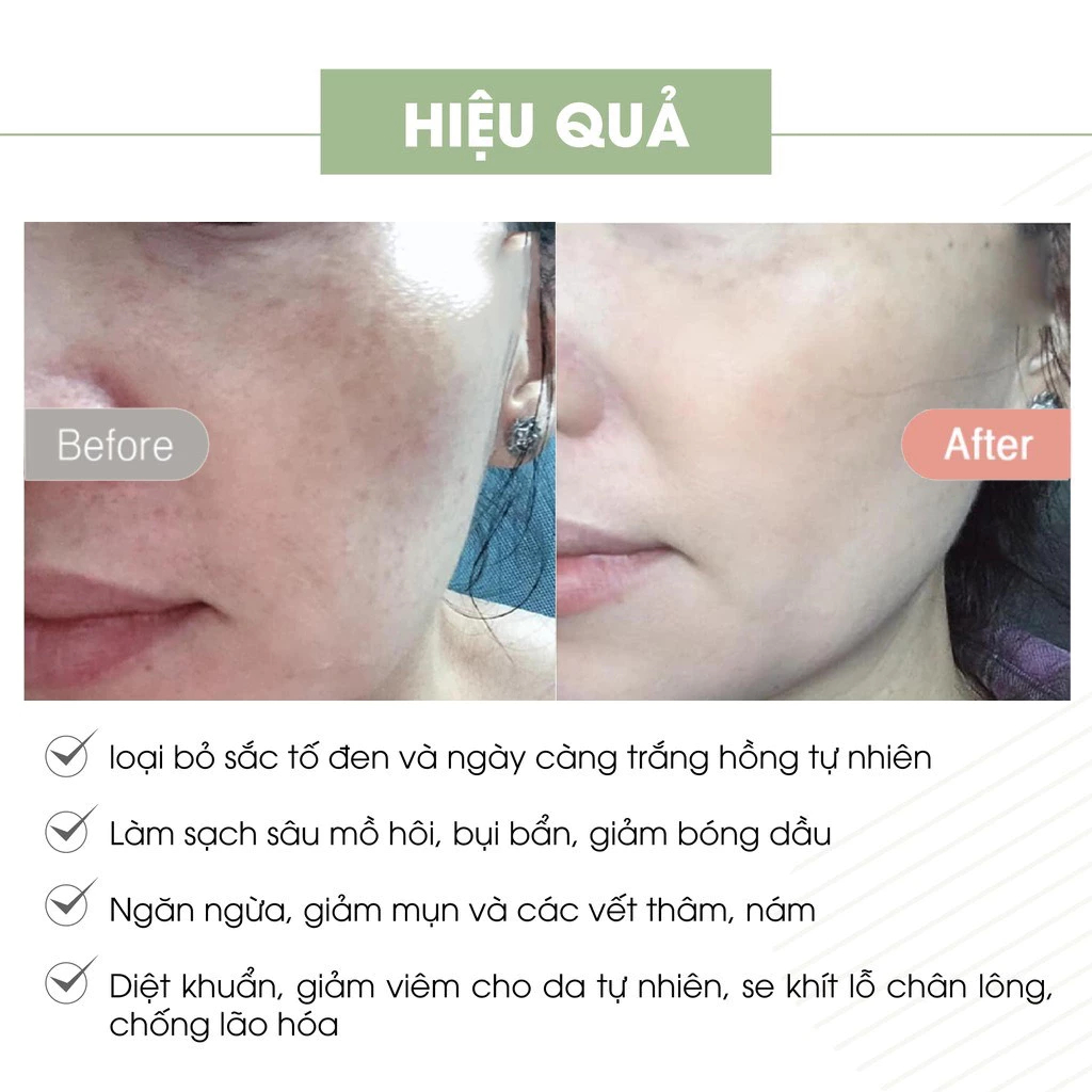 Kem face pháp A Mềm acosmetics, dưỡng trắng da mặt 20g mẫu mới nhất